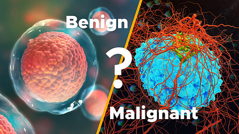 What's the difference between a tumour and cancer?