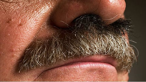 Why do nose, ear hairs become longer & thicker as we age