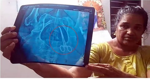 Usha (51) shows the X-ray of her abdomen which detected the scissors