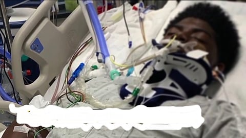 Brain dead patient on life support systems.