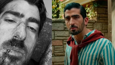 La foto ensangrentada de Jezzini tenía truco: así promocionó una serie de Netflix