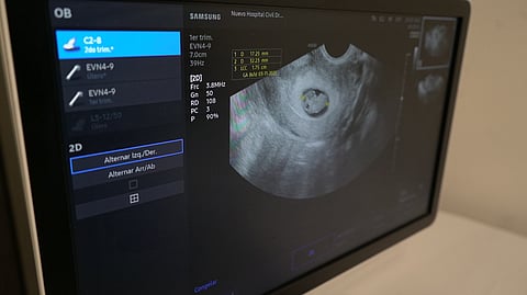 El Hospital Civil de Morelia ofrece aborto legal con acompañamiento médico, psicológico y social desde el consultorio 53