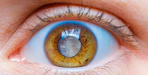 Fumar y beber alcohol en exceso perjudican tus ojos