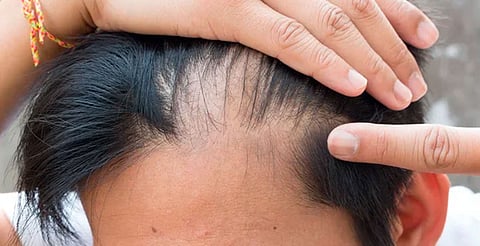 Antioxidantes, sueño y alimentación saludable ayudan a retrasar el envejecimiento capilar