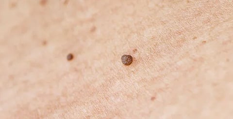 No hay evidencia científica que lo respalde como tratamiento eficaz