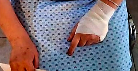 Ataca con machete a su hermana en Apatzingán; la víctima perdió un ojo y tres dedos 