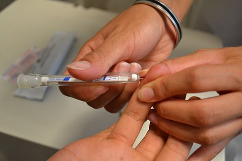 Más de 90% de personas con VIH usan tratamiento combinado en el IMSS