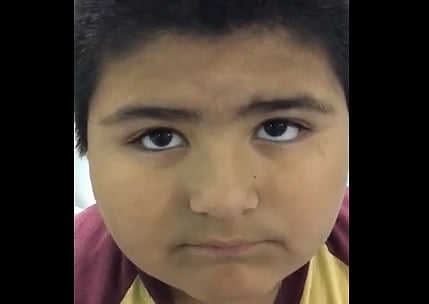 Operan a niño que se tragó un silbato por accidente [Video]