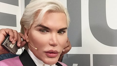 En redes sociales criticaron las modificaciones del hombre (Foto Instagram: rodrigoalvesuk)