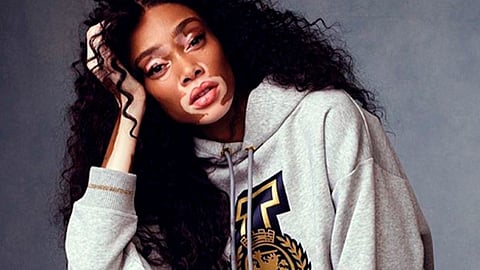 Participó en America's Next Top Model (Foto: IG/@winnieharlow)