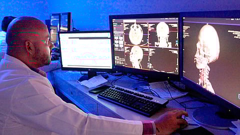 El segundo lunes de febrero se conmemora el Día Internacional de la Epilepsia (Foto Cortesía) 