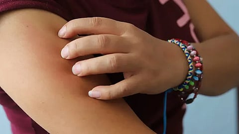 La causa exacta del síndrome de Guillain-Barré se desconoce (Foto: Cortesía)