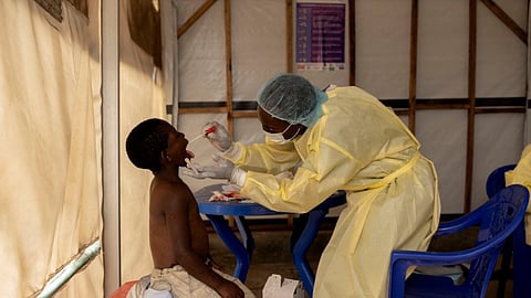FILE PHOTO: Christian Musema, a laboratory nurse, takes a sample from a child declared a suspected case Mpox - an infectious disease caused by the monkeypox virus that spark-off a painful rash, enlarged lymph nodes and fever; at the the treatment centre in Munigi, following Mpox cases in Nyiragongo territory near Goma, North Kivu province, Democratic Republic of the Congo July 19, 2024. 