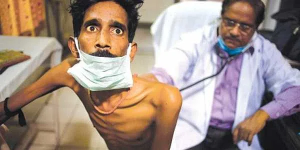 How Kerala is fighting TB, and winning 