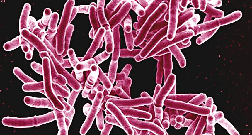 Tuberculosis bacterium can cause infertility in women, say experts  