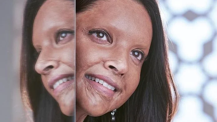 Meghna Gulzar’s ‘Chhapaak’ is a film about the indomitable human spirit