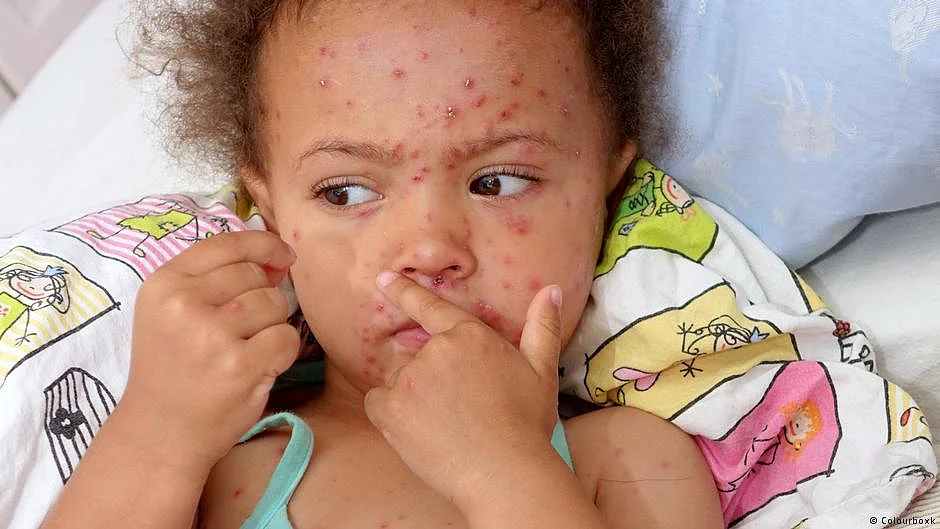 Representative (DW Photo)