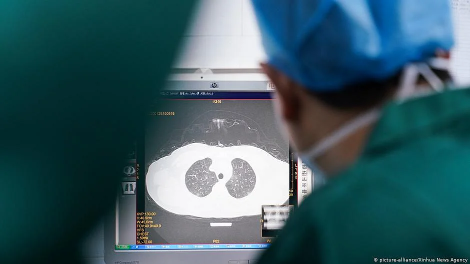 Representative image