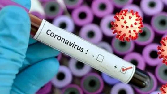 Lockdown alone won’t flatten India’s COVID-19 curve: Experts  