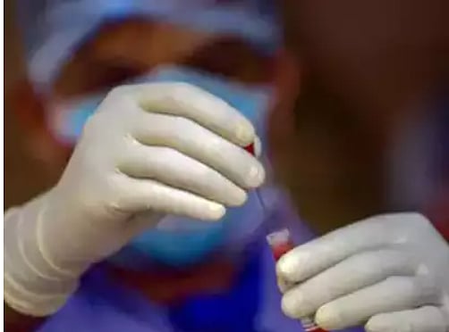 BHU lab closed for testing, samples being sent to Lucknow