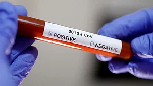 People coming to Delhi from 5 states will need to show negative COVID-19 test result: Officials