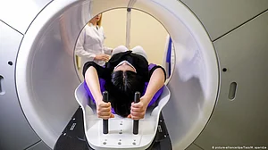 About 70 pc of premature cancer deaths in 2020 preventable, 30 pc treatable, says Lancet study