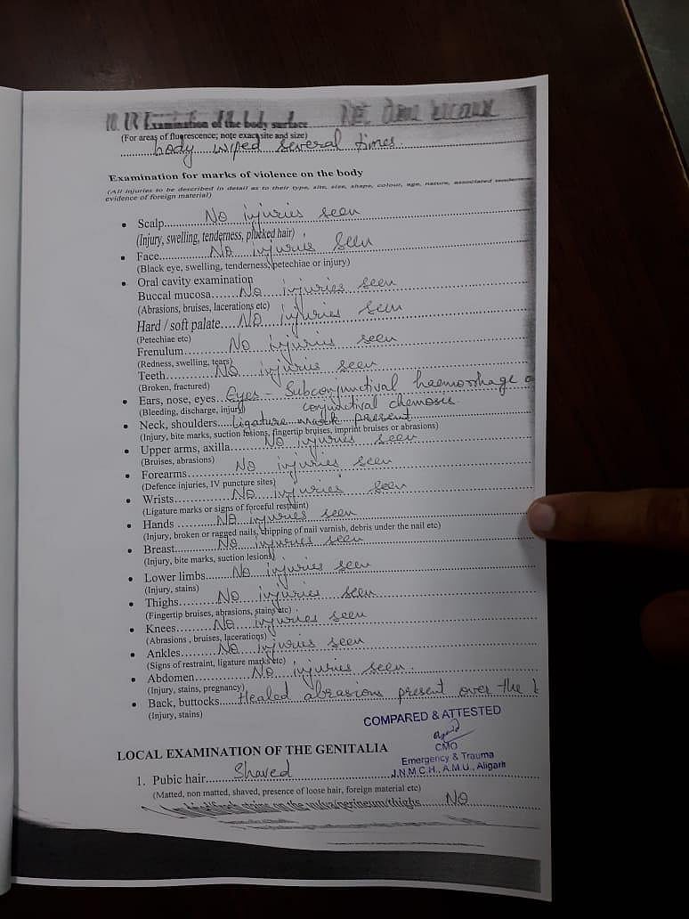 Hathras case: No meaning of FSL report after 11 days of rape, says CMO, Aligarh Hospital