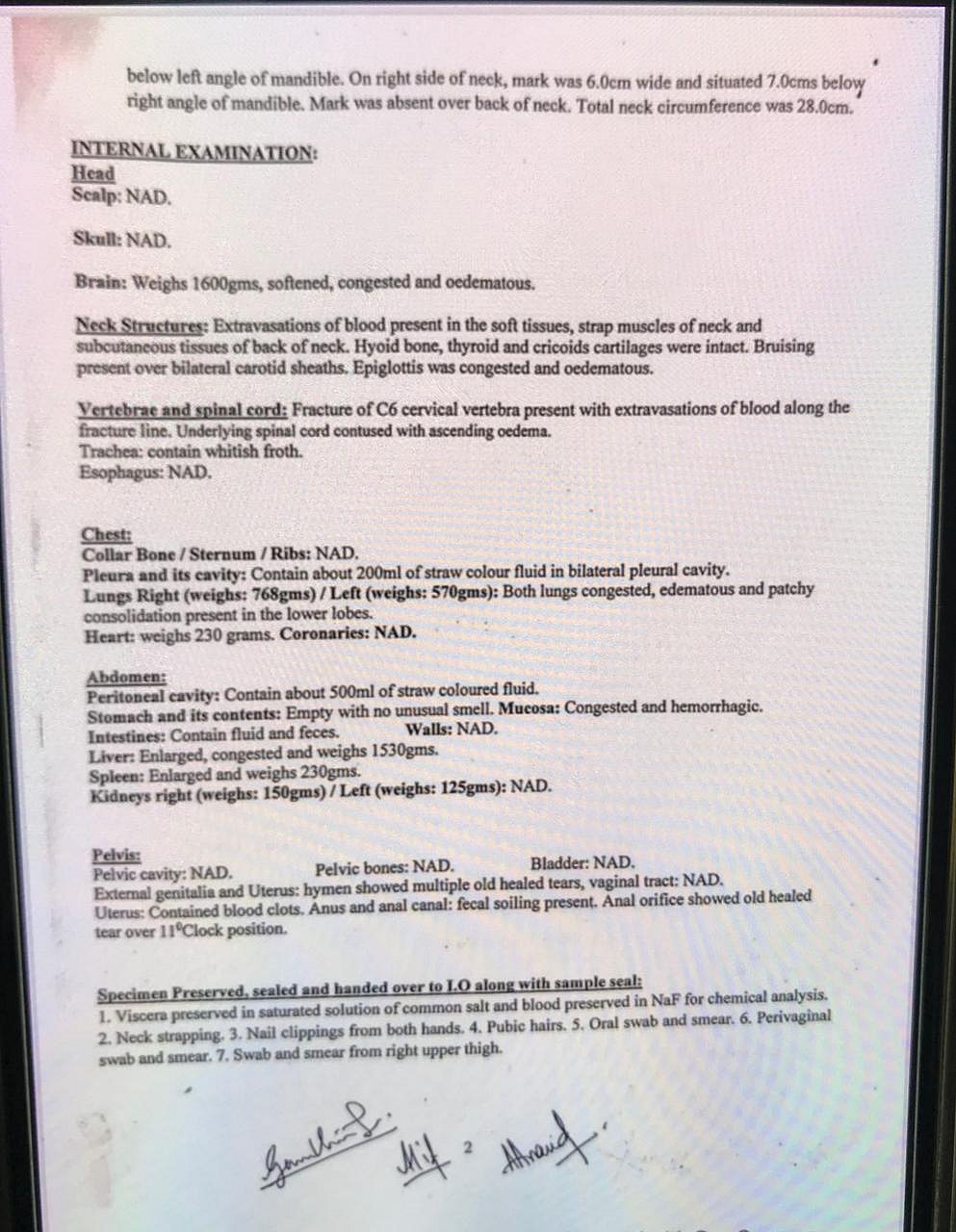 Hathras case: No meaning of FSL report after 11 days of rape, says CMO, Aligarh Hospital