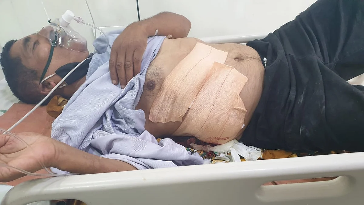 Bengaluru man shoots wife, tries to hang himself
