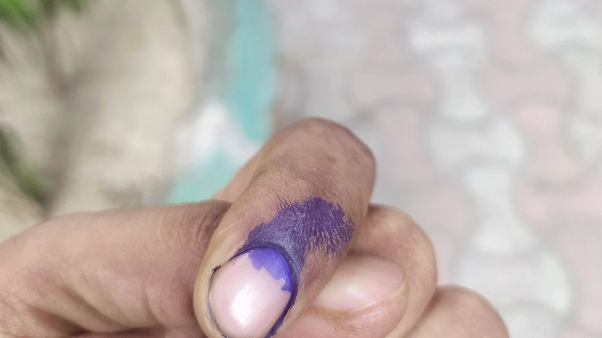 Representative Image