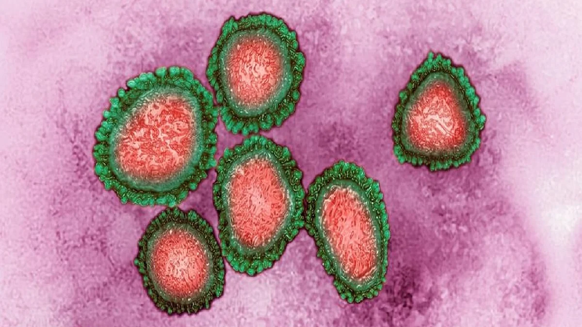 Representative Image