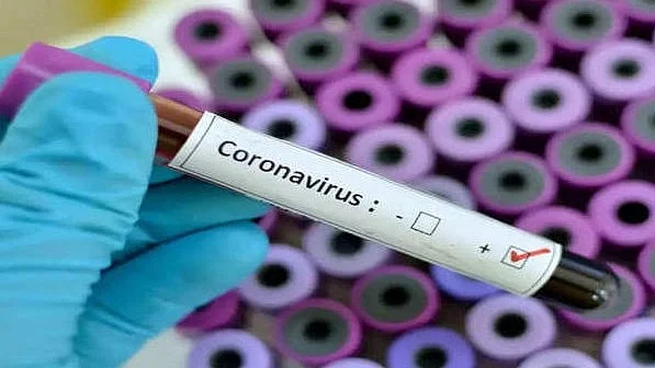 Lucknow reports highest single-day Covid spike in 2023