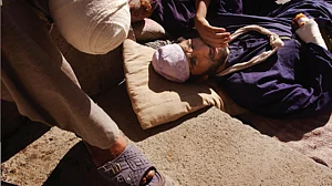 Representative image