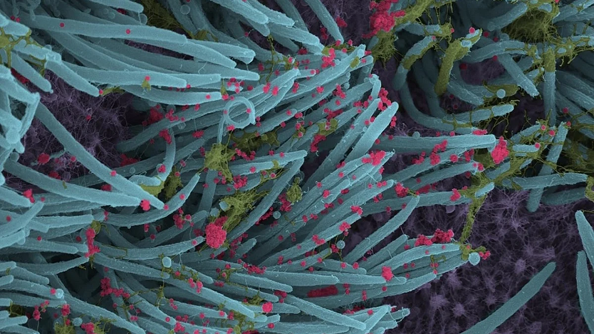 Representative Image