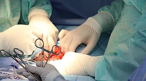 PGI doctors perform endoscopic removal of tumour through nose