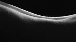 4 ways psoriasis can worsen if not managed well