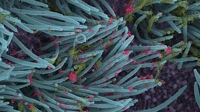 Delta-like SARS-CoV-2 variant may increase pandemic severity