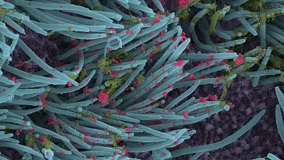 Lethal 'NeoCov' only 1 mutation away from infecting humans: Wuhan scientists