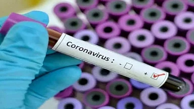 Lucknow University defers exams as 50 students test Covid positive