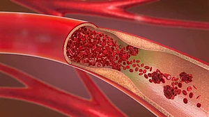 Blood substances to help identify long Covid patients discovered in new research
