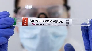 Israel reports new cases of monkeypox, measles