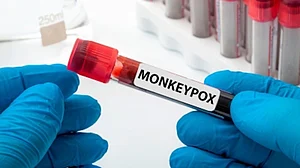 New Zealand confirms first two monkeypox cases of community transmission