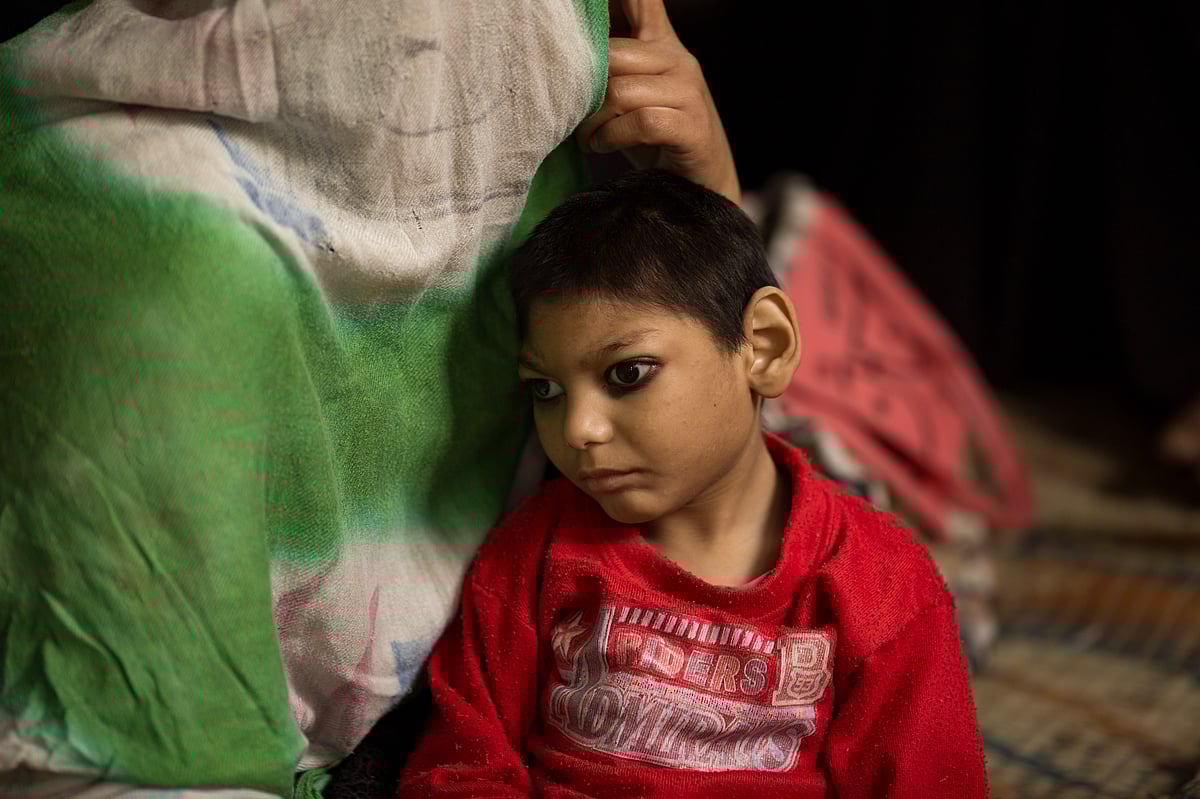 A child seen at Chingari Rehabilitation Center. Chingari cares for victims of the Bhopal Gas Disaster. About 3,000 people died and 5,58,000 people were injured. The site still has toxic chemicals 38 years later needs to be disposed safely. Local people live in the shadow of this horrific plant. The victims made a statue to remember the victims.