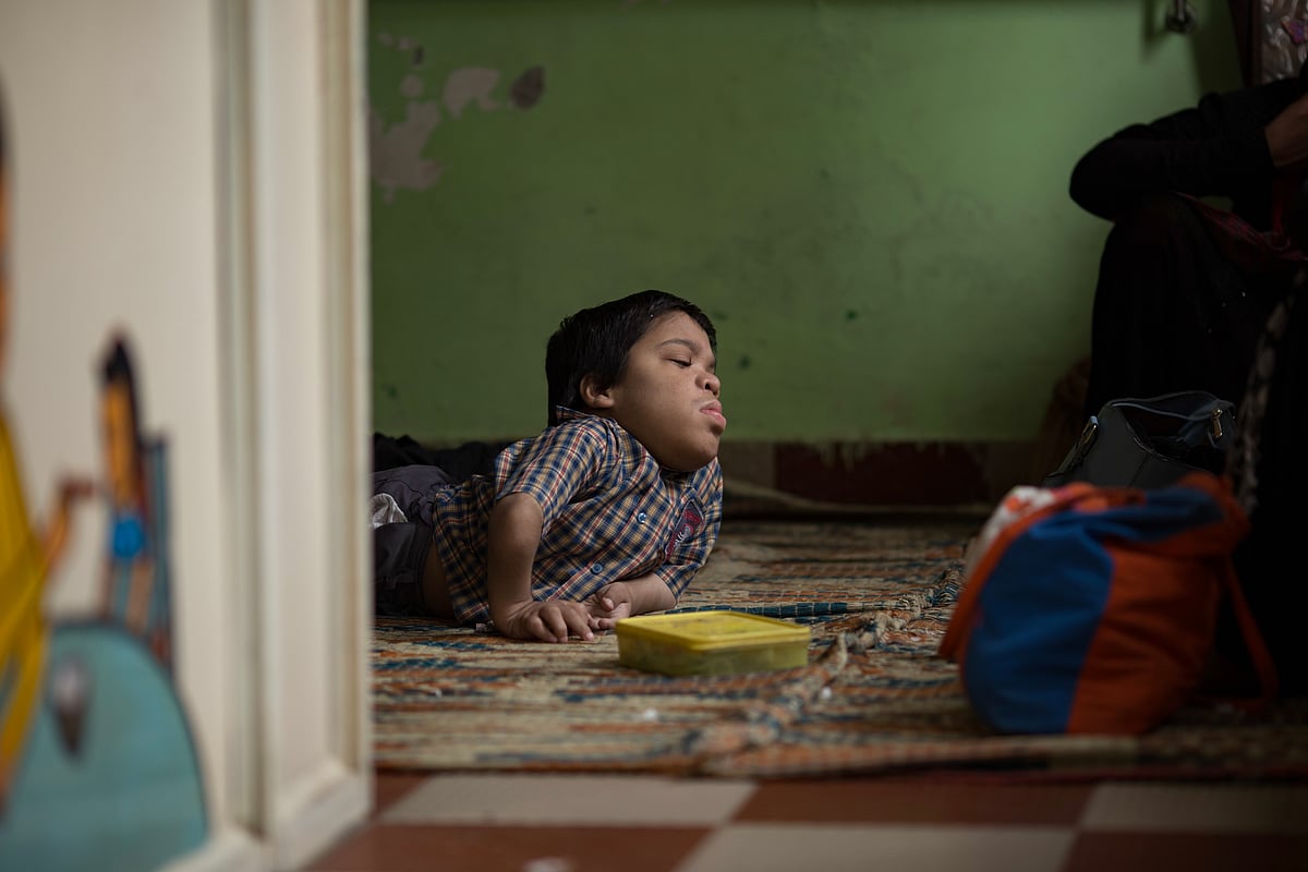 Another victim child seen at Chingari Rehabilitation Center. Over 500,000 people were exposed to the toxic methyl isocyanate (MIC) gas as they slept.