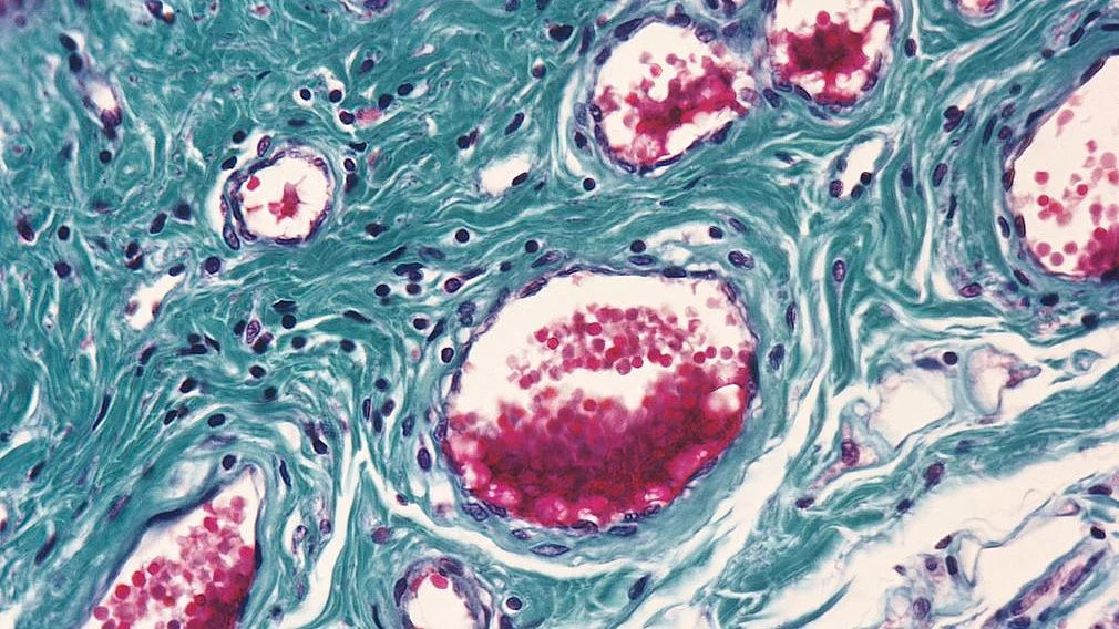 Blood vessels in salivary gland (photo: Getty Images)