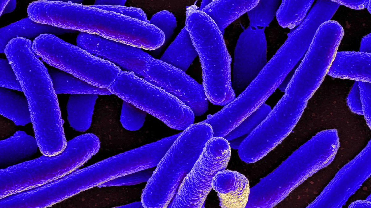 Representative image of a bacteria (photo: IMAGE POINT FR/NIH/NIAID/Universal Images Group via Getty Images)