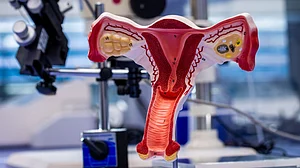 Stem cell-derived components may help treat PCOS