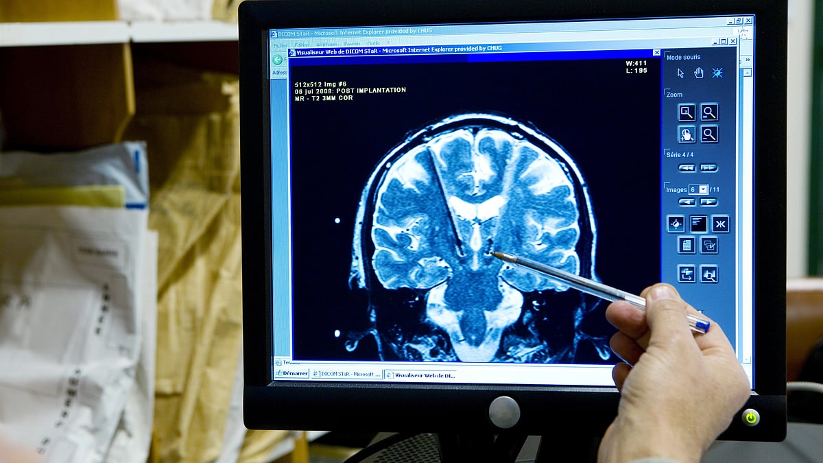 Brain doesn't rewrite its blueprint post-injury, say researchers (Representative image) (photo: BSIP/UIG Via Getty Images)