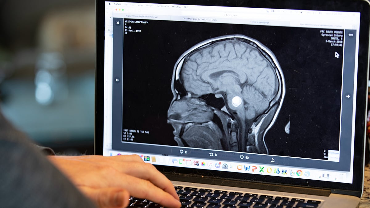 Adults with ADHD three times more likely to develop dementia, research finds