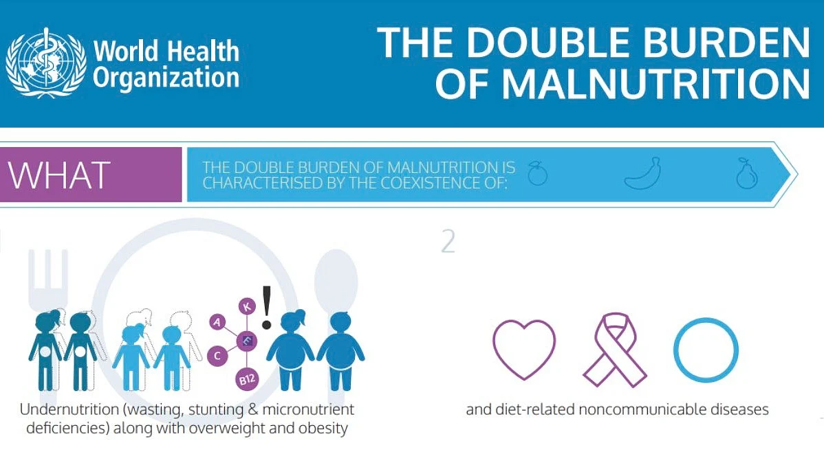 Obesity is a form of malnutrition that those undernourished in childhood are especially prone to (image courtesy @UN_Nutrition/X)